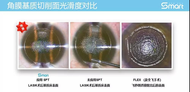 【關(guān)注】女兵報(bào)名已經(jīng)開始，可視力不達(dá)標(biāo)怎么辦？(圖8)