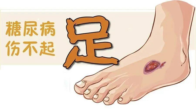 【擴(kuò)散】指甲剪太短！代價可不只是痛和流血……(圖3)