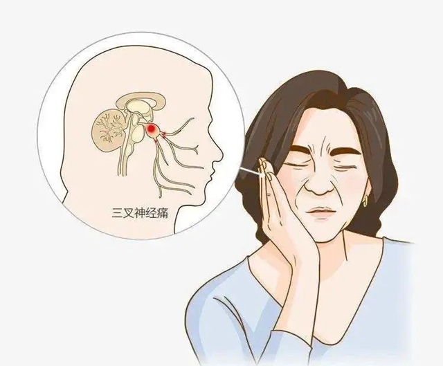 瀘州一老人臉被“刀割”，痛不欲生！(圖6)