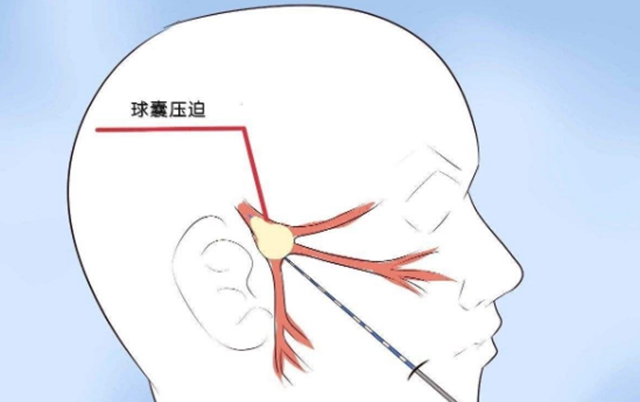 瀘州一老人臉被“刀割”，痛不欲生！(圖7)