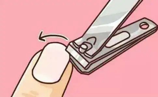 十指連心痛，瀘州小伙踢球整出甲溝炎！(圖7)