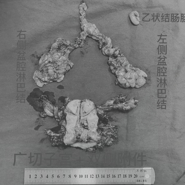 【人物】靠技術圈粉的婦科男醫(yī)生(圖5)