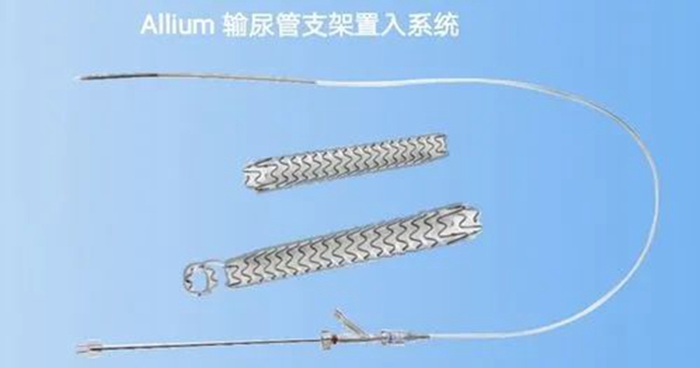 【關注】宜賓一男子遭了，輸尿管里安支架！(圖4)