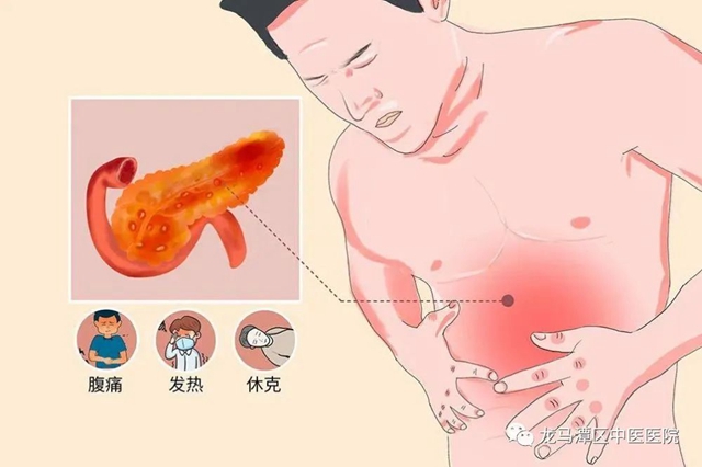 【中醫(yī)藥】胰腺炎，用中藥灌腸有效？
