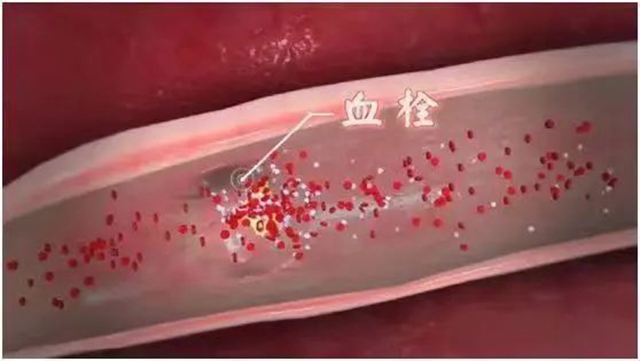 【分享】雞蛋的又一好處被發(fā)現(xiàn)，怎么吃有講究！