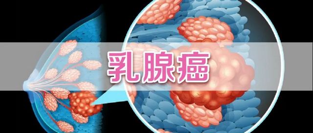 圍剿“紅顏殺手”，西南醫(yī)大附院MDT團(tuán)隊發(fā)表罕見病例報道登上全球頂級期刊
