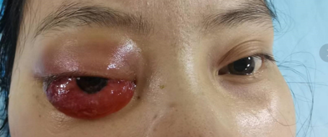 八年前母親因病去世，現(xiàn)在，女兒突發(fā)同樣的疾病，結(jié)果……