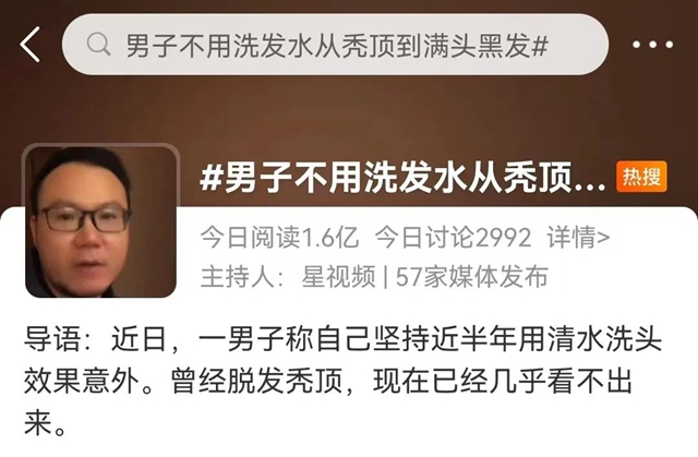 【圍觀】清水洗頭，反而不脫發(fā)了？