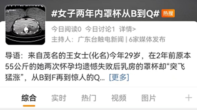 女子兩年內罩杯從B到Q，竟是……