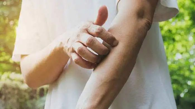 【圍觀】男子皮膚像癩蛤蟆，10年無果……