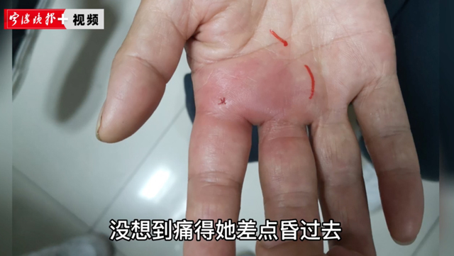 【提醒】擴(kuò)散！這種魚，有毒！