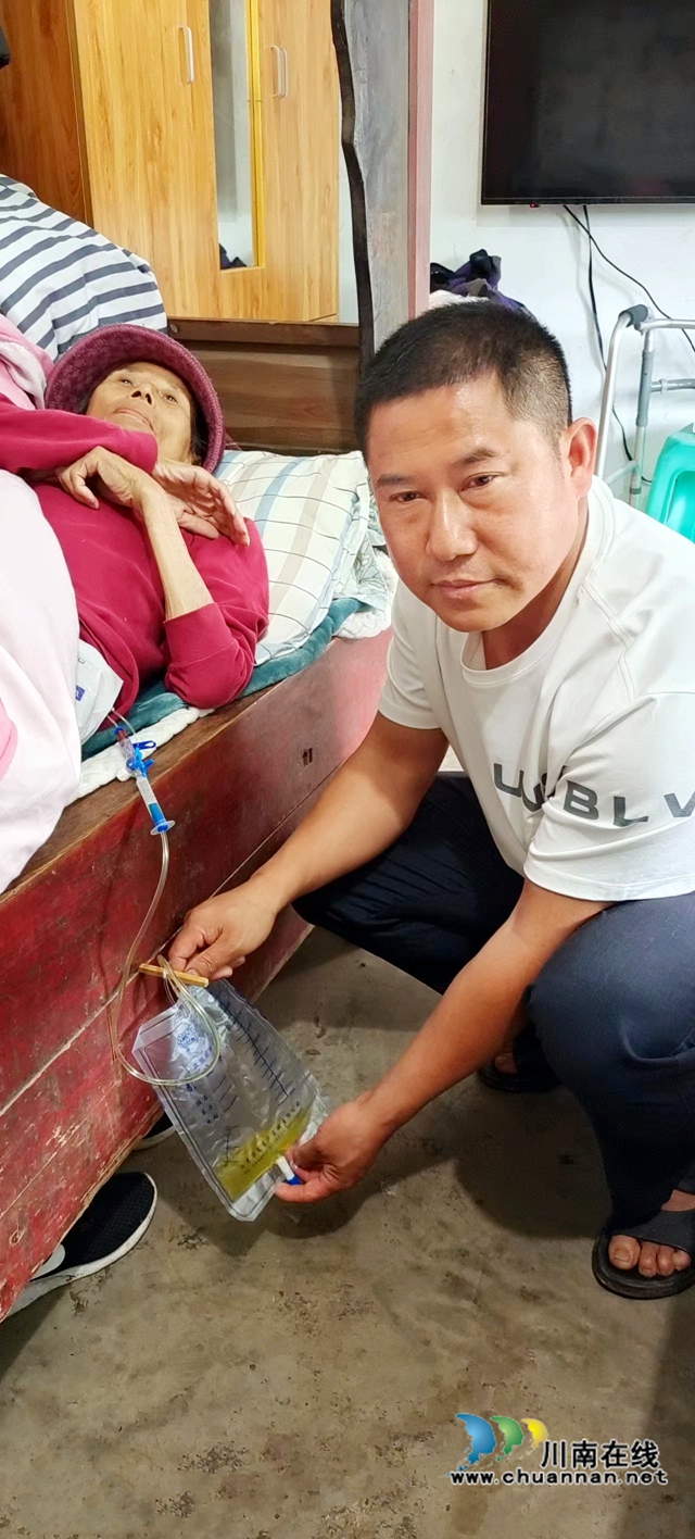 圖2：鐘傳杰為母親導(dǎo)出腹腔積液.jpg