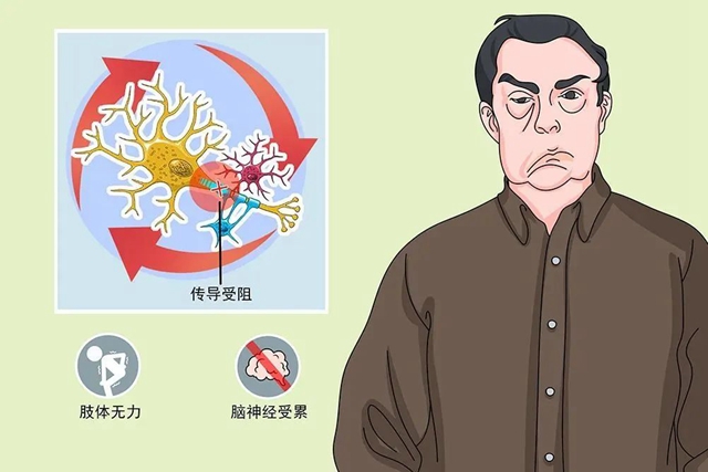 【罕見(jiàn)病】多為急性發(fā)病，面癱也會(huì)致命！