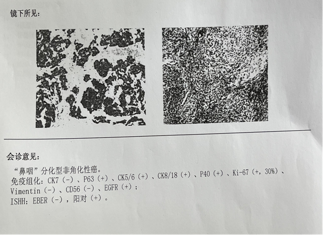 【圍觀】僅三個(gè)月，腫瘤就消失了，癌癥有那么可怕嗎？