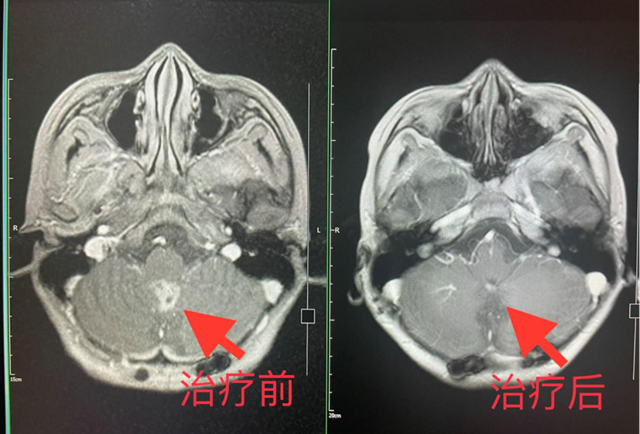 【擴(kuò)散】2名瀘州孃孃腦殼長(zhǎng)“包”？