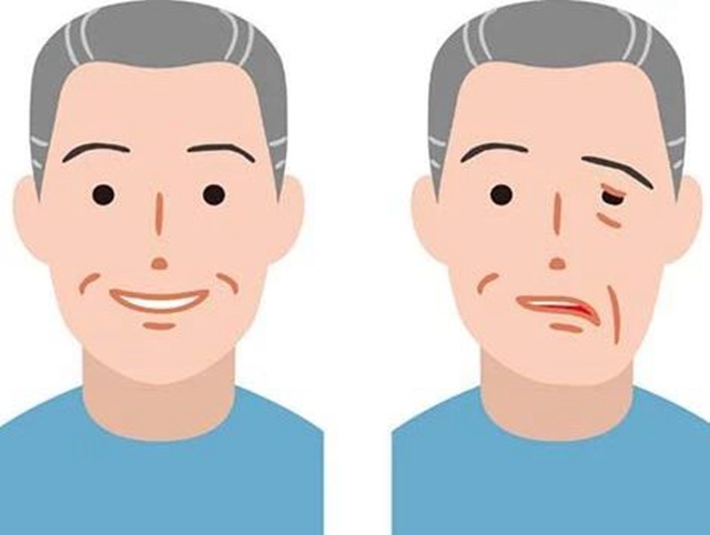 【降溫】天冷了，別當(dāng)精神小伙，當(dāng)心成歪嘴