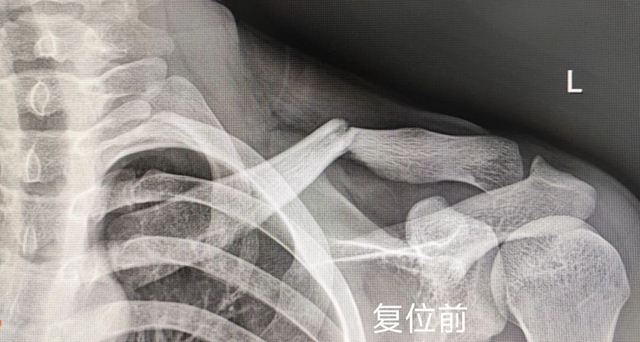 【圍觀】瀘州又一“爬樹哥”，這回遭了……