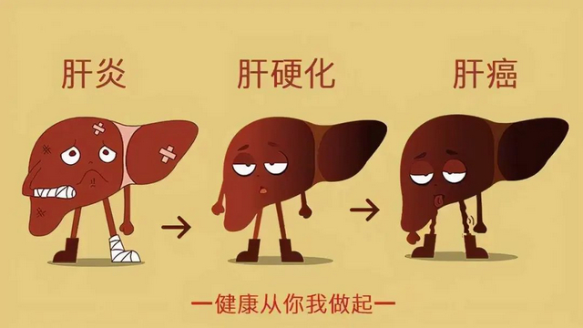 【警惕】從肝炎到肝癌，只有3步！有這6個癥狀要當(dāng)心……