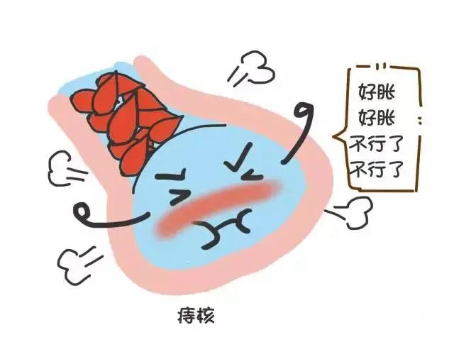 【關(guān)注】瀘州一初中生一個痔瘡引發(fā)嚴重貧血，暈倒在廁所！