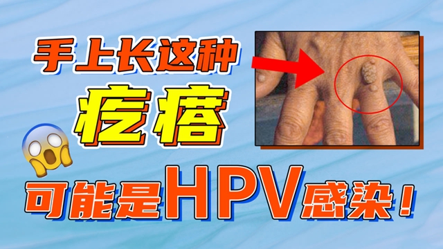 【警惕】一身長(zhǎng)疣，HPV感染惹得禍？