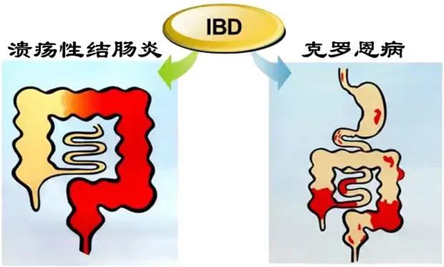 號稱“不死的癌癥”，看看中招沒有？