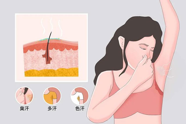 【科普講堂】這個(gè)夏天，來(lái)和腋臭做個(gè)了斷吧！