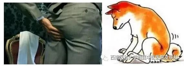 【警惕】大腿根癢得不得了，別撓了，要傳染……