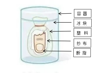 【?？萍夹g(shù)】驚心！又是電鋸！裝修師傅們千萬要小心了！