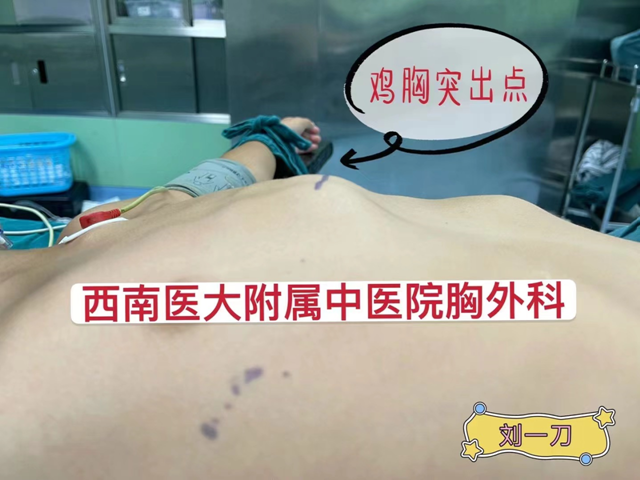【驚險】鋼絲斷在小伙胸腔……