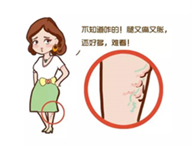 不痛不癢，也能致命！腿上出現(xiàn)這些癥狀，一定要警惕