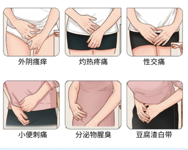 “破案了”，婦科炎癥是這么來的