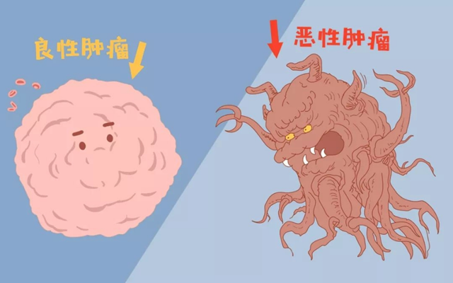 震驚！比“戀愛腦”更可怕的是“腫瘤腦”！