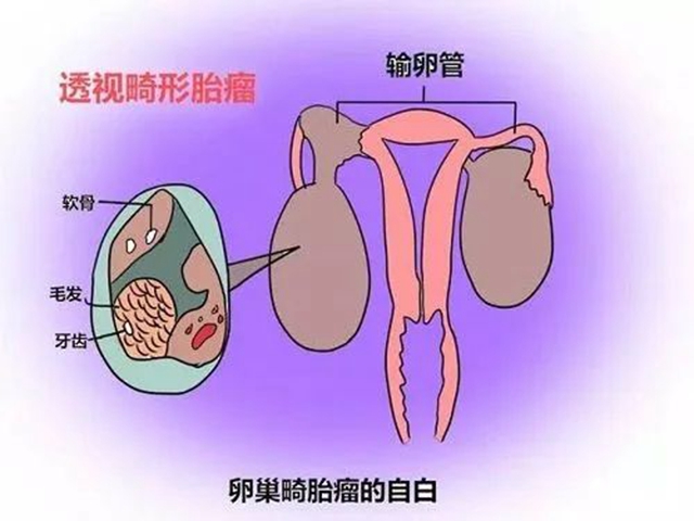 【圍觀】16歲花季少女“懷了個怪胎”，重達8斤......