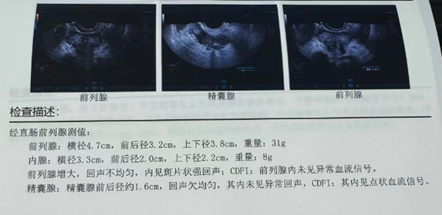【擴散】男子36歲就中招！一個習慣，讓這種病提前20年？