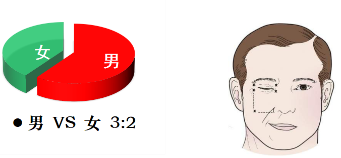 左跳財，右跳災(zāi)？眼皮跳的吉兇大解密→