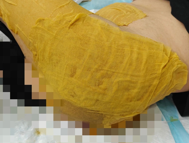 【圍觀】毒蛇鉆進女子被窩，先咬PP后鎖喉...…