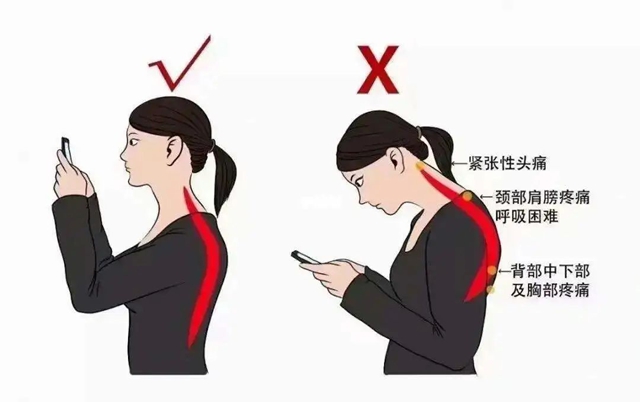 【擴散】手指發(fā)麻、低頭肩膀痛，趕緊自查