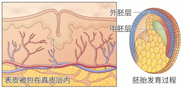 【圍觀】男子背上長(zhǎng)“痘痘”，還能擠出“豆腐渣”……