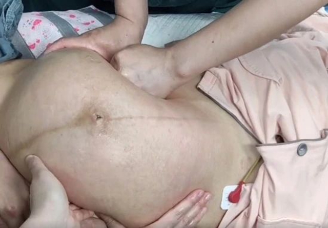 【厲害】又一例！2秒鐘，醫(yī)生徒手扭轉(zhuǎn)胎位不正