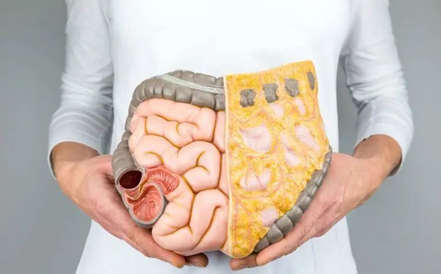 腸5.jpg