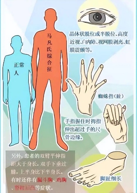 【醫(yī)患故事】險象環(huán)生，男子5進(jìn)鬼門關(guān)，多科協(xié)作成功救治