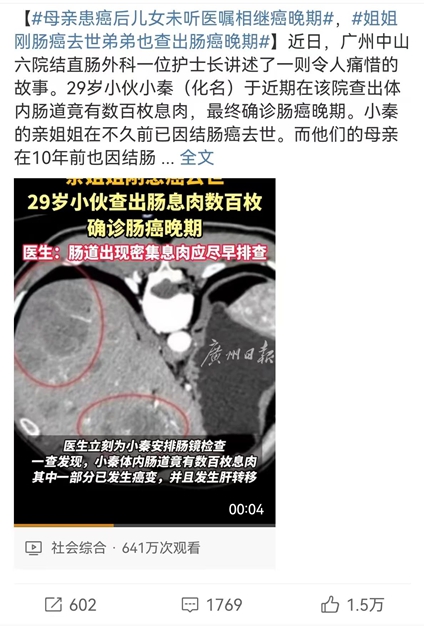【關注】29歲小伙查出數百枚腸息肉，確診腸癌晚期