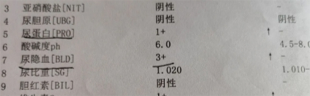 【警惕】女子一家三代都有血尿，外婆、媽媽、舅舅都遭了，有這些癥狀要當心