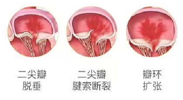 心2.jpg