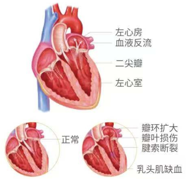 心1.jpg