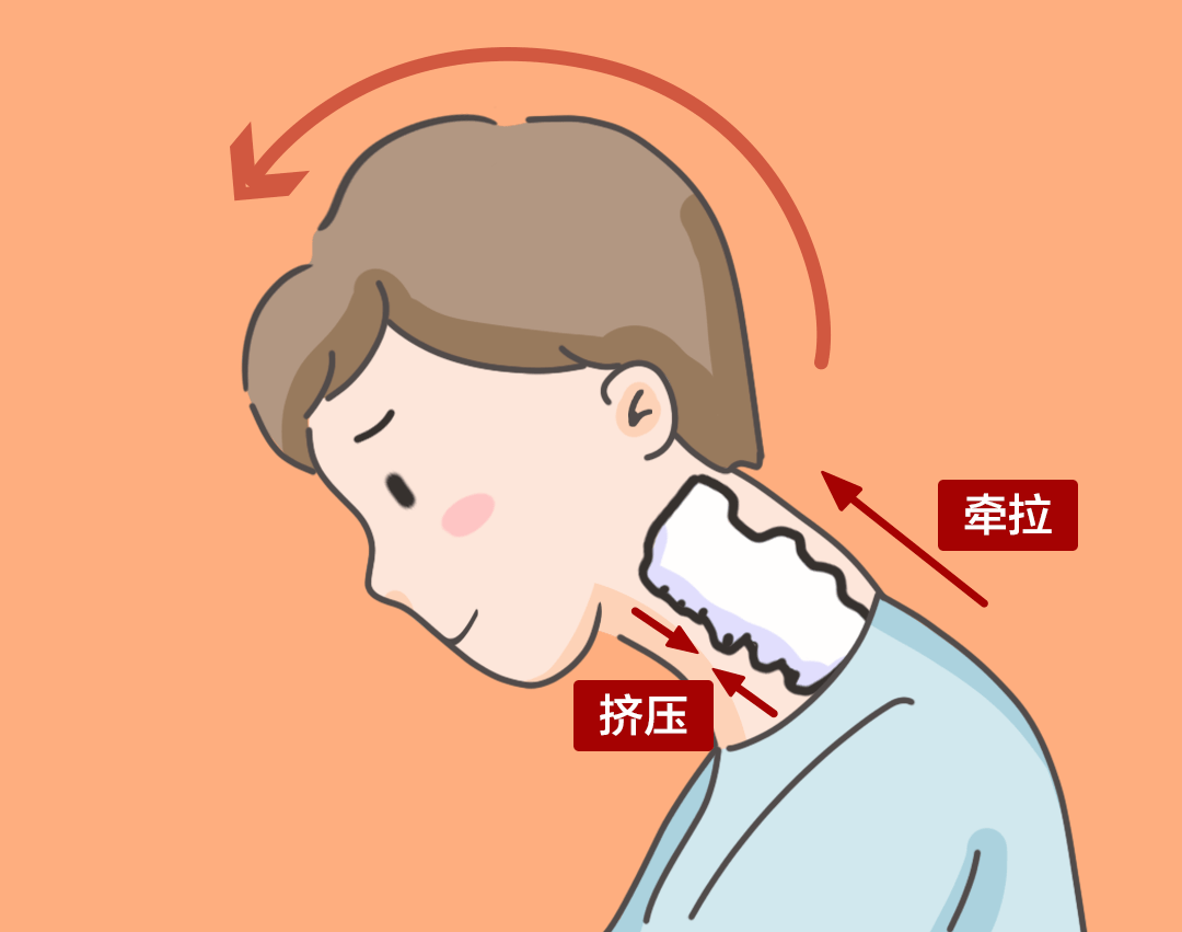 【警惕】長時間低頭玩手機？怪不得經(jīng)常頭痛……
