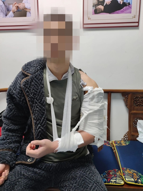 骨折7.jpg