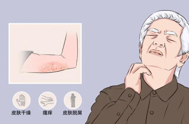 老年瘙癢癥：72歲的老伯，全身癢得睡不著！