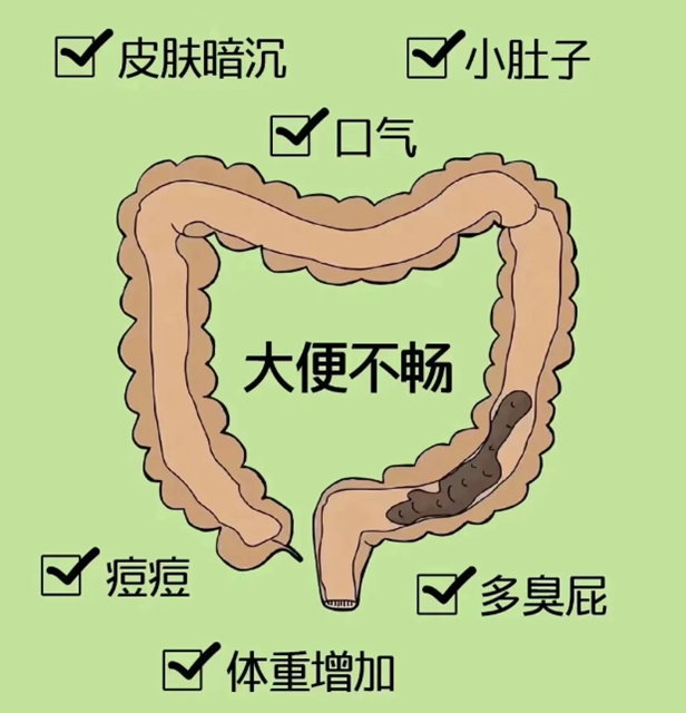 腸3.jpg