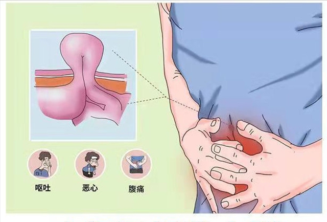 【關(guān)注】大爺肚子鼓起半個(gè)“足球”大包，竟是……